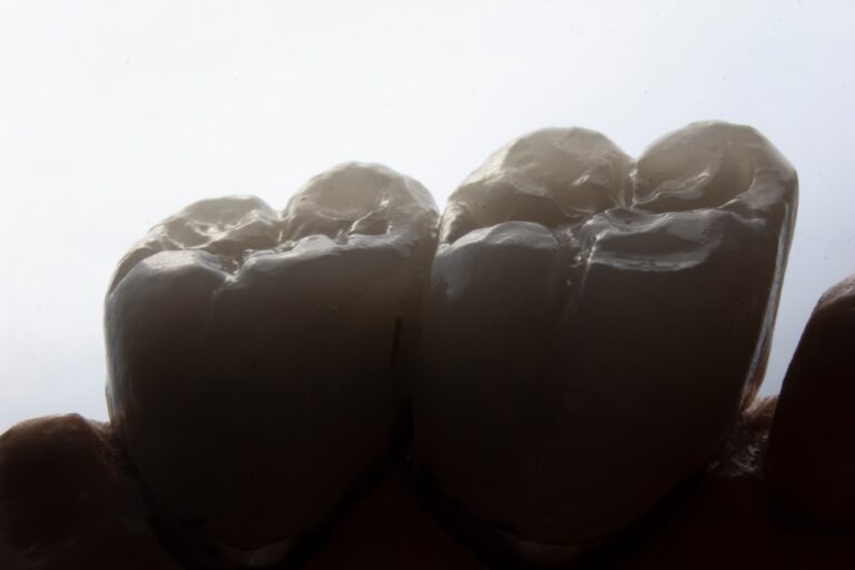 Jak leczyć ból zęba - co zrobić, gdy boli ząb